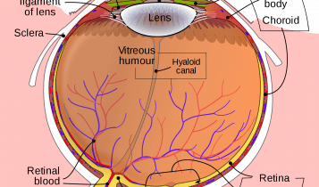 ইয়াগ পেরিফেরাল আইরিডোটমি Yag peripheral iridotomy laser treatment 3 ইয়াগ পেরিফেরাল আইরিডোটমি Yag peripheral iridotomy laser treatment 4